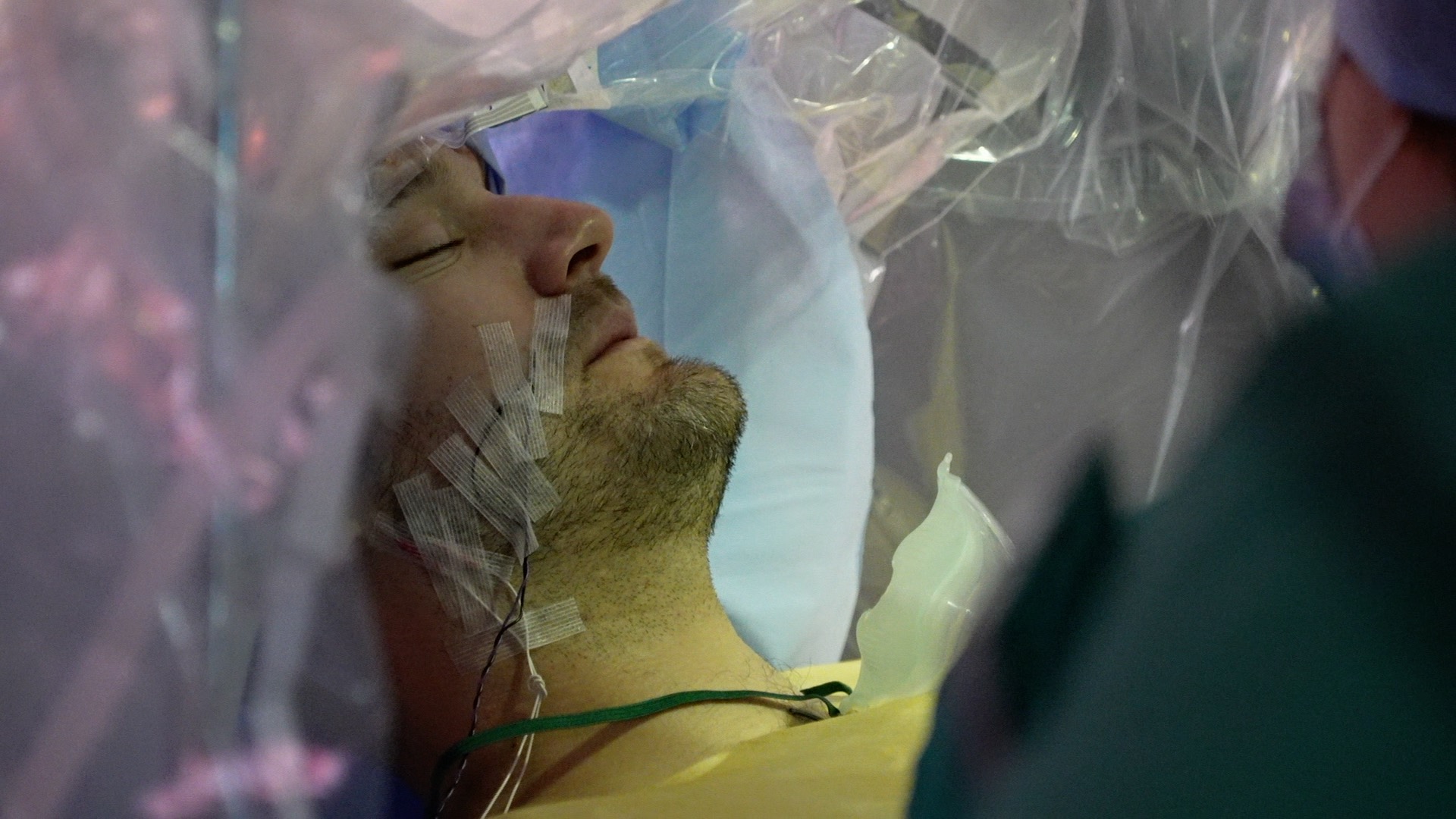Daniel Covington, brain cancer patient during surgery at Addenbrooke's