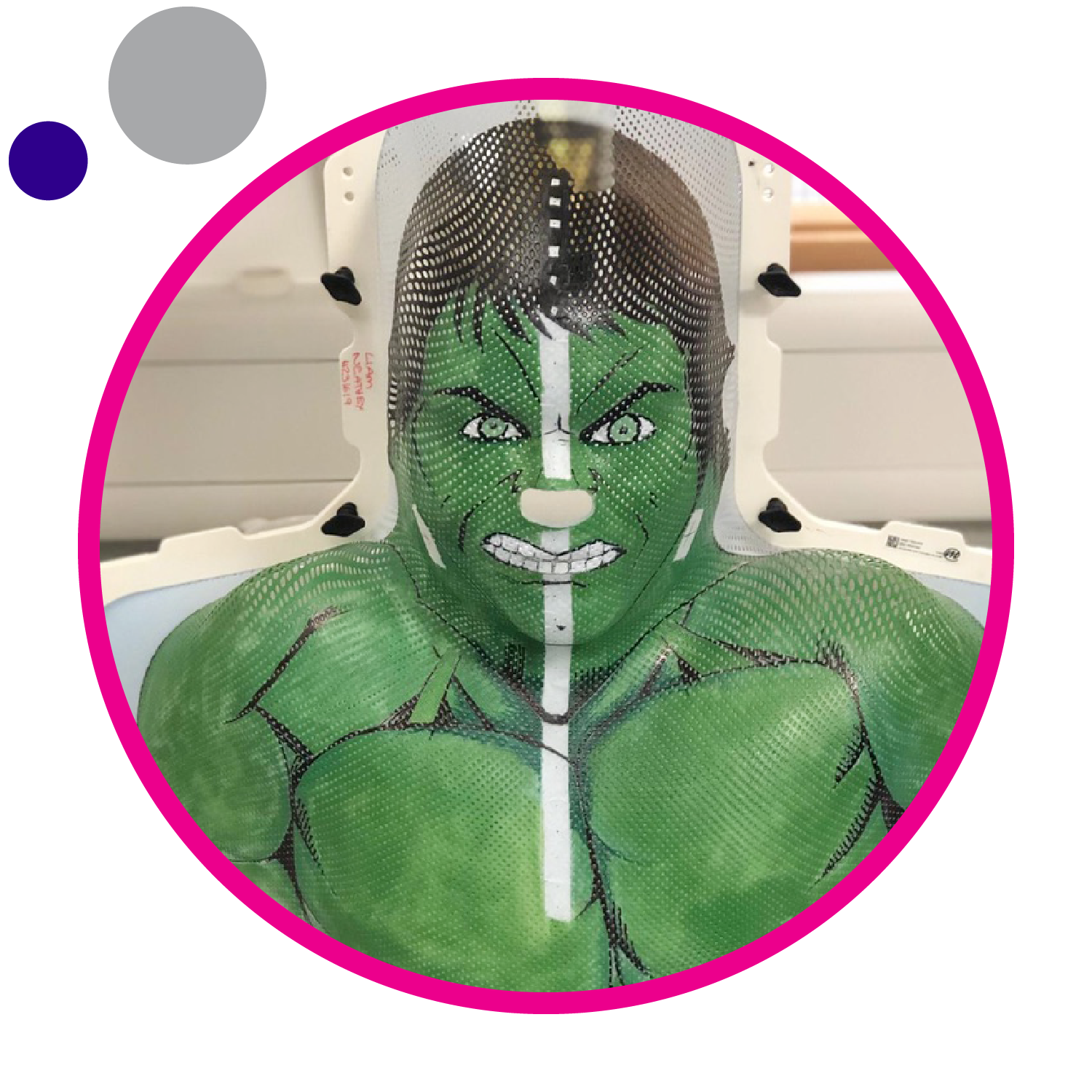 A child's radiotherapy mask decorated to look like the Hulk.