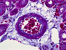 Stained cross-section through kidney blood vessel