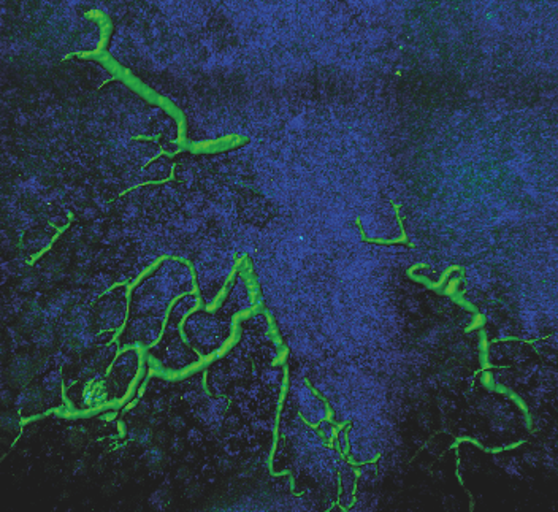 Microscopy image of circulating epithelial stem-like cells (green) from a donor animal making apparently normal structures in recipient's kidney.
