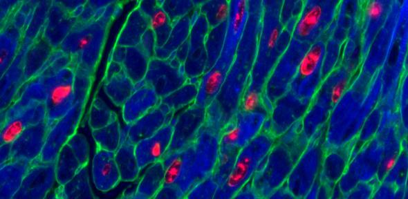 Adult mouse heart muscle cells