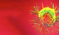 Breast cancer cell credit: NIH Image Gallery