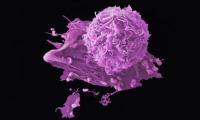 Breast cancer cells credit: Anne Weston, Francis Crick Institute