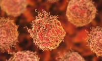 Prostate cancer cells (Credit: KATERYNA KON/SCIENCE PHOTO LIBRARY)